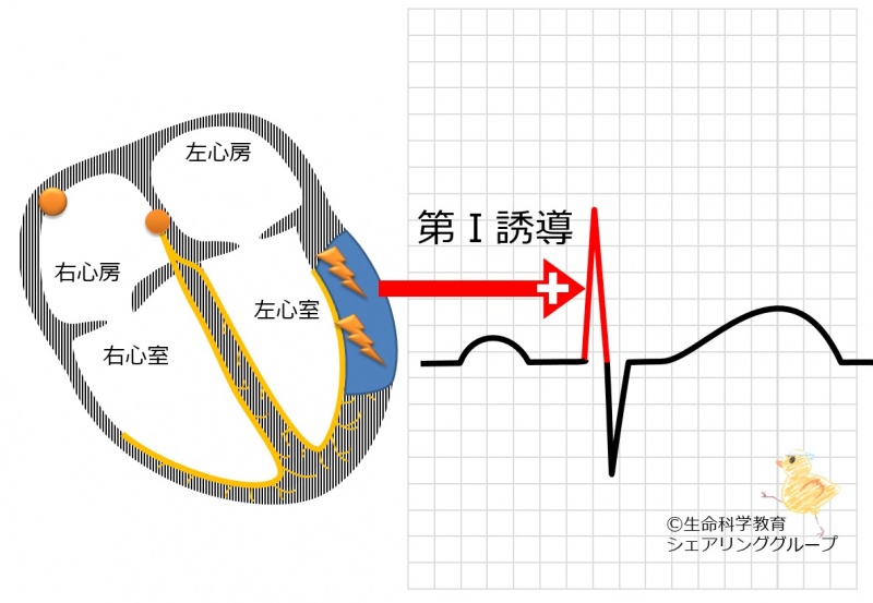 ファイル:第Ⅰ誘導 R波の意義.jpg