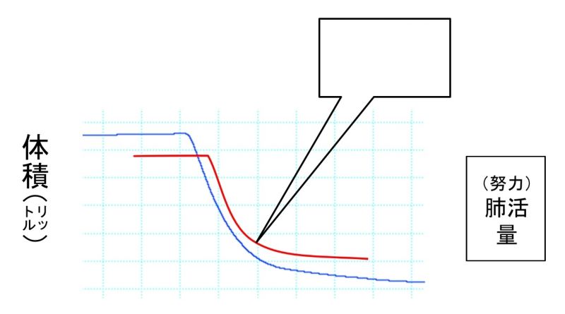 ファイル:PulmFuncTestRestrictive-basic-wb.jpg